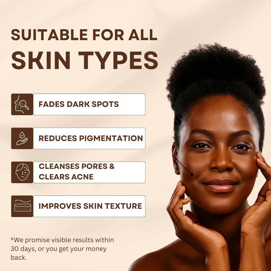 Anti-Acne & Dark Spots African Soap