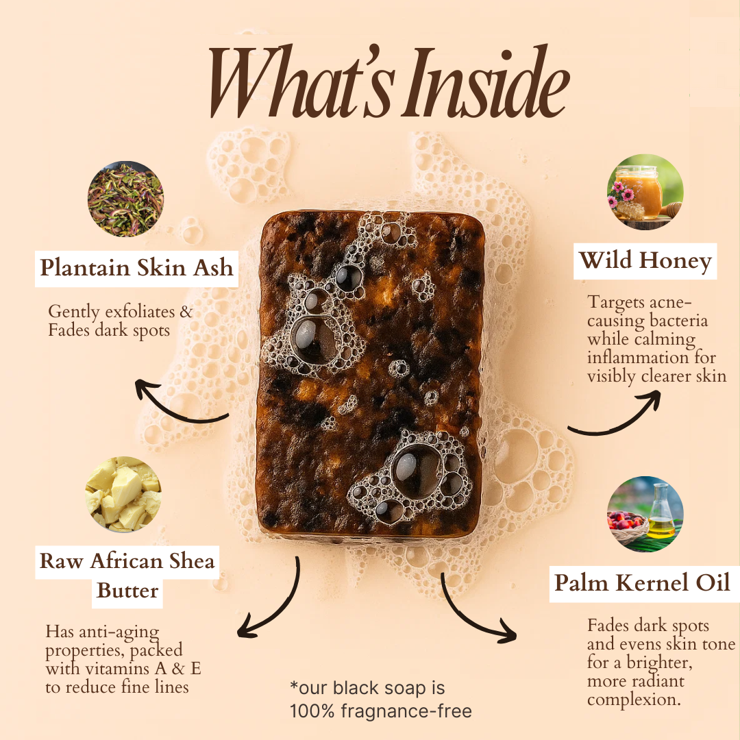 Anti-Acne & Dark Spots African Soap